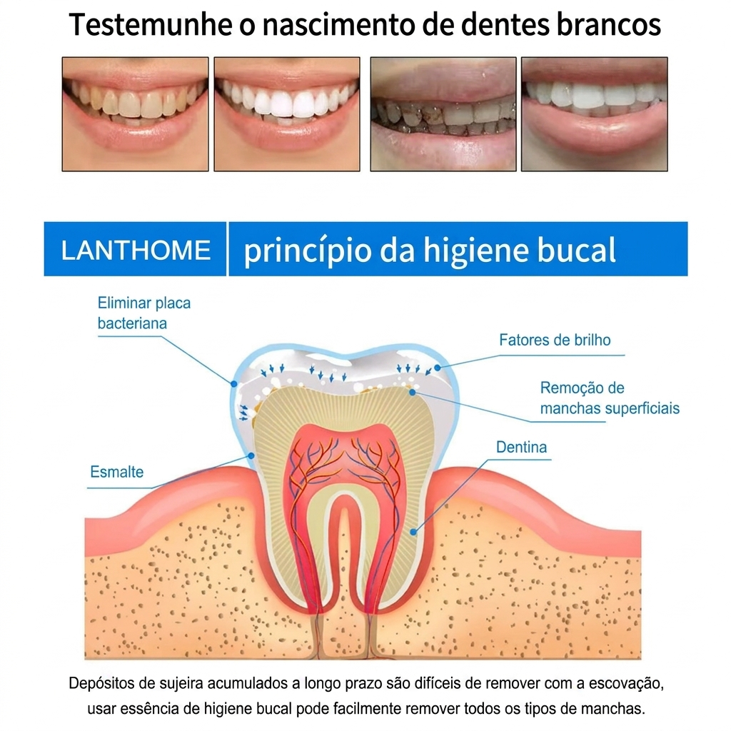Caneta Gel Dental 4g